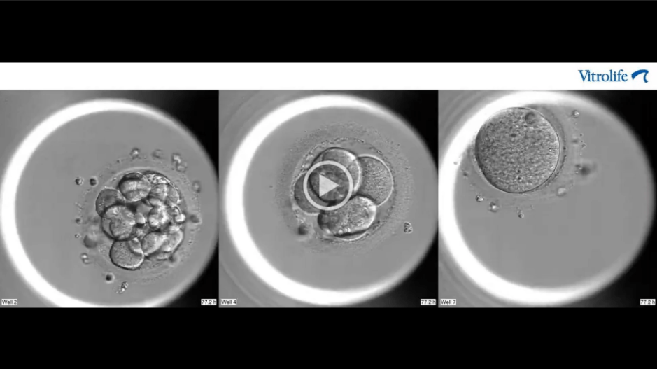 Vídeo real: evolución de tres embriones (Embryoscope+)